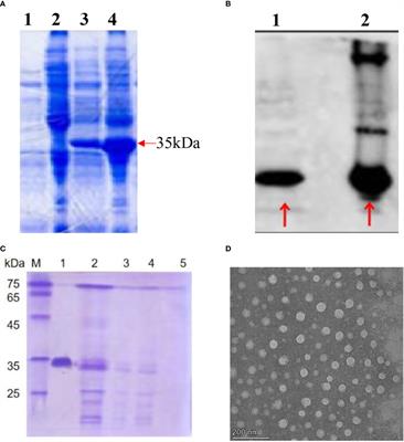 GE11-antigen-loaded hepatitis B virus core antigen virus-like particles efficiently bind to TNBC tumor